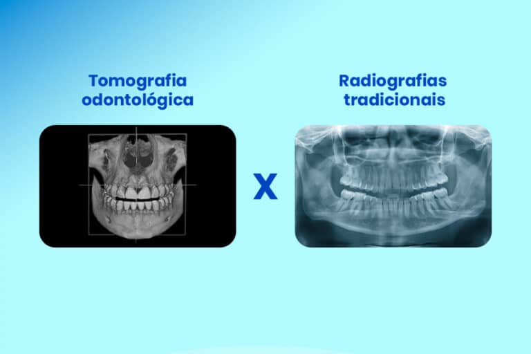 radiografia odontológica