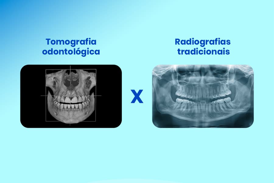 radiografia odontológica