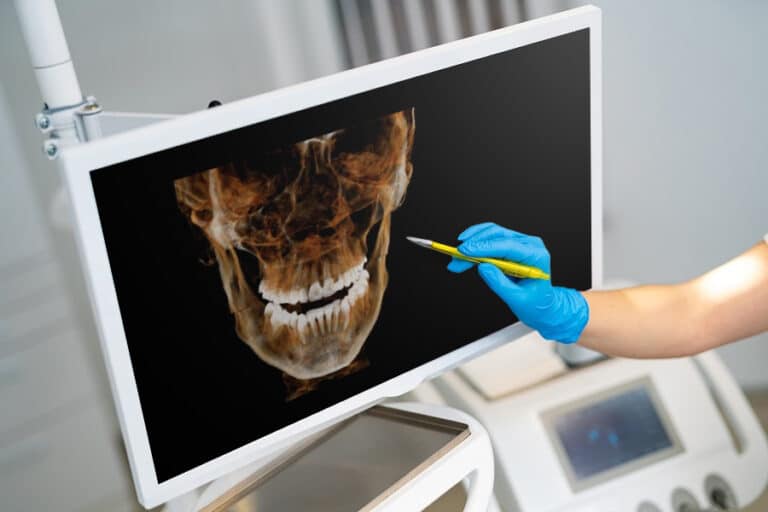 Radiografia odontologica digital