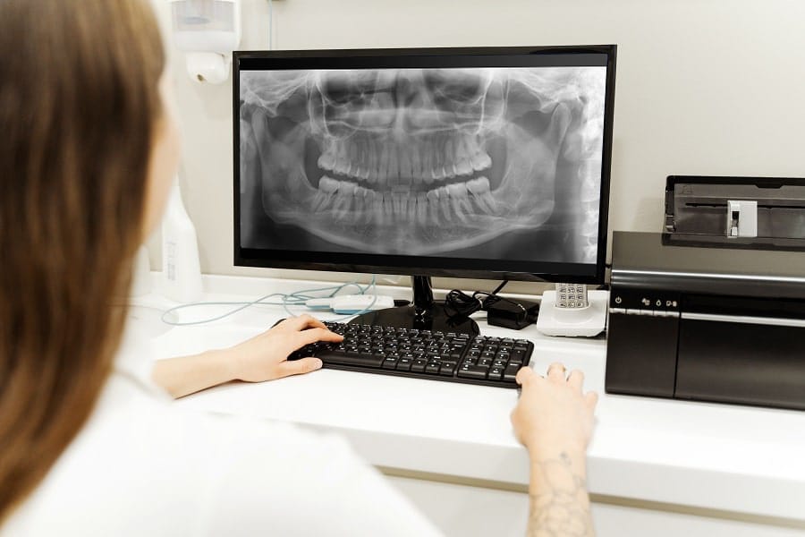 Radiografia panorâmica odontológica